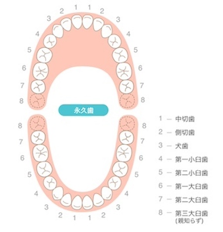 親知らずを含む歯式のイラスト｜親知らずは抜歯した方が良い？痛みや腫れとリスク、治療の流れを解説｜渋谷マロン歯科Tokyo